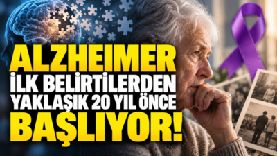 21 Eylül Dünya Alzheimer Günü kapsamında yapılan değerlendirmelerde, Alzheimer hastalığının