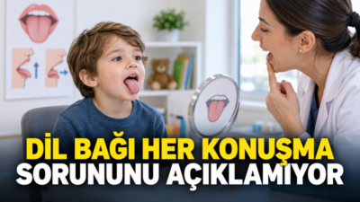 Çocuklarda dil bağının kısa, kalın veya belirgin görünmesi, tek başına